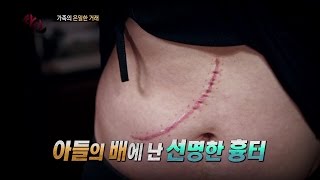 간 이식을 받기위해 연극을? 뻔뻔한 남편의 최후_채널A_싸인 126회