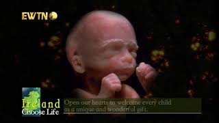 Archbishop Eamon Martin   Choose Life prayer   EWTN Ireland 1