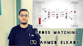 Cross Matching   التوافق عملى