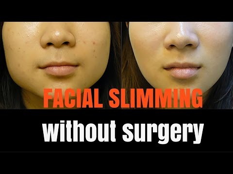 Facial slimming - how it works! Facial slimming - how it works!