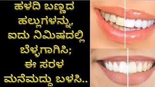 @watchashwini  #teeth whitening  in 1 minutes. ನಿಮಿಷದಲ್ಲಿ ನಿಮ್ಮ ಹಲ್ಲುಗಳು ಬಿಳುಪಾಗಲು