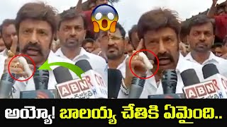 Nandamuri Balakrishna Finger Injured | NBK 107 | Leo Entertainment