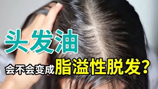 【脱发常识】脂溢性脱发解析 | 为什么头发出油多不一定会导致脱发？