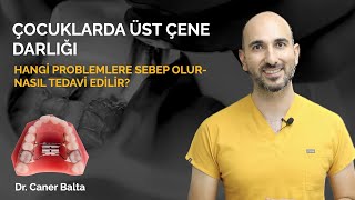 Çocuklarda Üst Çene Darlığı Hangi Problemlere Sebep Olur ve Çene Genişletme Tedavisi Nasıl Yapılır?