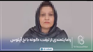 رضایتمندی از لیفت گونه با نخ آبتوس