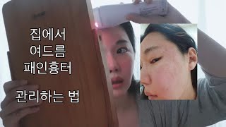 패인흉터, 여드름 흉터 집에서 살차오르게 하는 법/ 가정용프락셀/ 트리아 스킨리뉴레이져