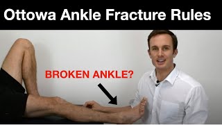 What are the Ottowa Ankle fracture Rules?