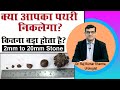 क्या आपका पथरी निकलेगा ? कितना बड़ा स्टोन यूरिन से निकल सकता है  || Dr. Raj Kumar Sharma - Urologist