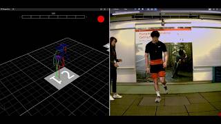 Motion Analysis and Sports Performance Lab: What to Expect - Stanford Medicine Children's Health