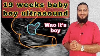 Baby boy ultrasound| gender before birth| gender reveal| 19 weeks ultrasound| Anomaly scan