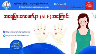 အရေပြားလေးဖက်နာ (SLE) အကြောင်း