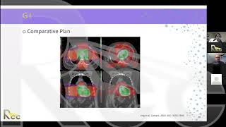 IMRT 2.0 | Session 15 | High yield clinical applications of IMRT Part 2