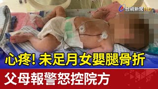 心疼!未足月女嬰腿骨折 父母報警怒控院方