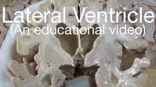 LATERAL VENTRICLE -  BOUNDARIES (An educational video)