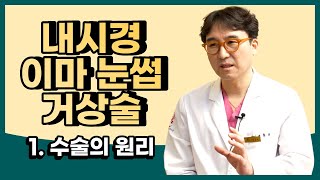 내시경 이마 눈썹 거상술_수술의 원리(feat. 이마와 미간, 상안검)