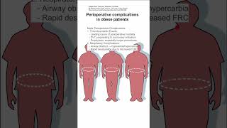 Perioperative complications in obese patients