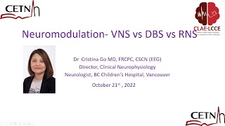 Neuromodulation in Epilepsy: VNS/RNS  Dr Tina GO