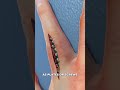 fixing a fractured finger 3d animation