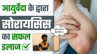 आयुर्वेदा के द्वारा सोरायसिस का मिला सफल इलाज | Psoriasis Patient Testimonial