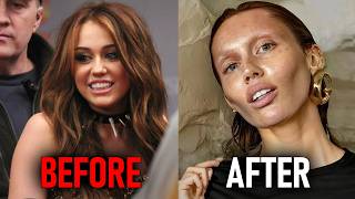 Celebrities Who COMPLETELY RUINED Their Faces Trying To Stay YOUNG
