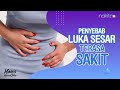 Waspadai 3 Hal Penyebab Luka Jahitan Caesar Terasa Sakit