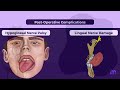 sialolithiasis full video oral medicine medi study go