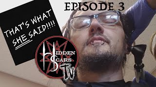 Hidden Scars TV Episode 3: Visit To The Clinic For An Ear Infection, Recording Bass, Dad-Cameo