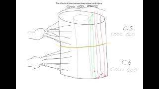 The effects of blunt versus sharp spinal cord injuries