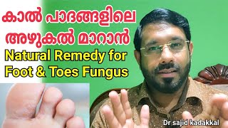 Natural Remedy for Foot and Toe Fungus, കാൽ വിരലുകൾ അഴുകുന്നത് മാറാൻ നാച്ചുറൽ മരുന്ന്