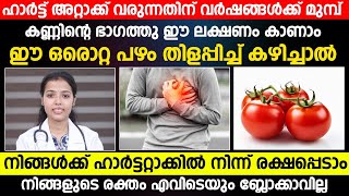 ഈ ഒരൊറ്റ പഴം തിളപ്പിച്ച് കഴിച്ചാൽ നിങ്ങൾക്ക് ഹാർട്ട് അറ്റാക്കിൽ നിന്നും രക്ഷപ്പെടാം|