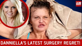 The Shocking Aftermath of Danniella Westbrook's Recent Nose Surgery