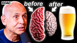 The Ugly Truth About Alcohol’s Effect On Your Brain. | Dr Daniel Amen