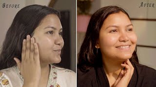 Korean glass skin transformation- 7 days challenge with wow rice water and ceramide face wash