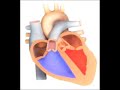 Estenosis Aortica reumatica con iao leve