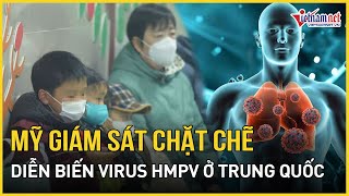 Mỹ siết chặt giám sát virus viêm phổi giống Covid-19: Liệu có nguy cơ lan rộng toàn cầu | VietNamNet