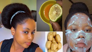 JINSI YA KUONDOA MAFUTA NA MADOA SUGU USONI#skincare #