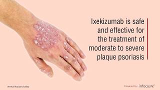 Ixekizumab is safe and effective for the treatment of moderate to severe plaque psoriasis