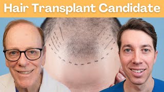 How to Pick the Perfect Candidate for a Hair Transplant