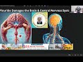 affect fluoride your brain central nervous system what you need to know malayalam