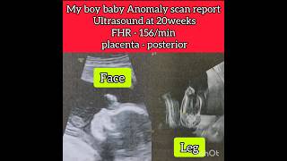 Ultrasound Anomaly scan report at 20weeks boy baby or girl #shorts #boy #babyboy #ultrasound #scan