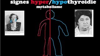 🔴 Dr Astuce - HYPER/HYPOTHYROIDIES EXPLIQUÉES CLAIREMENT