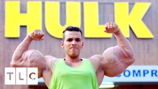 Bodybuilder Injects Himself Unregulated Oil | Real Life Hulks