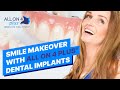 Smile Makeover with ALL ON 4 Dental Implants