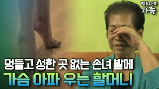 [다큐 ‘가족’ 92-3] 멍들고 성한 곳 없는 손녀 발에 가슴 아파 우는 할머니