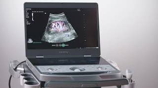 10  Advanced Imaging Applications Mindray MX7 Ultrasound