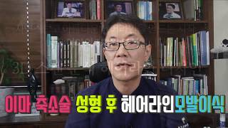 이마축소 성형 후 흉터라인  헤어라인모발이식