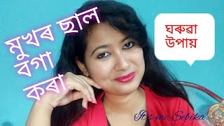 ছাল বগা-ধুনীয়া কৰা ঘৰুৱা উপায় || How to get fair Skin