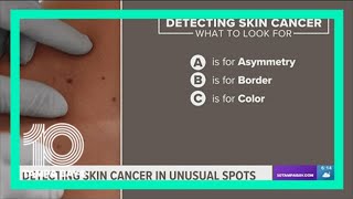 Quit putting off that skin cancer screening, doctors say