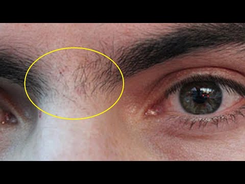 How can I remove eyebrow hair permanently at home?