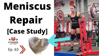 Meniscus Repair Surgery Physical Therapy [Case Study - Powerlifter Chrissy Peracchi] FPF Show E:63